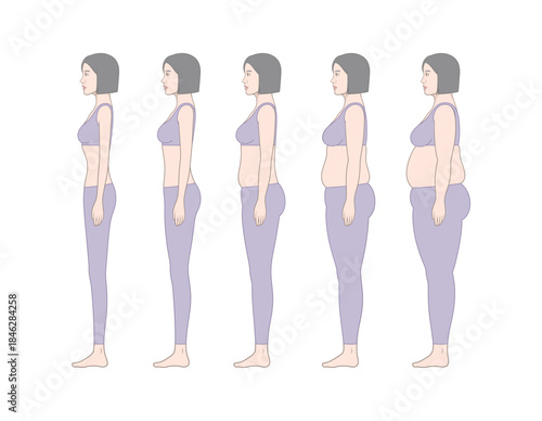 Female Body Weight Change Side View Illustration Showing Underweight to Obesity Stages, Standing Woman Profile Anatomy and BMI Health Comparison