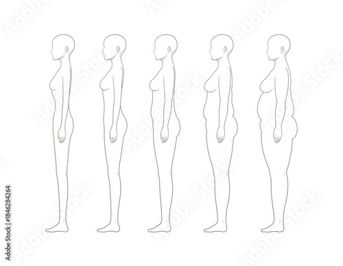 Female Body Weight Change Side View Illustration Showing Underweight to Obesity Stages, Standing Woman Profile Anatomy and BMI Health Comparison