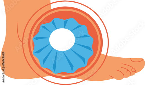 Ankle injury pain relief illustration with ice pack therapy isolated on white background medical healthcare flat vector design