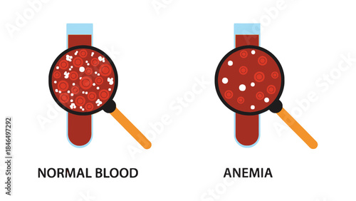 Blood cells under microscope comparison