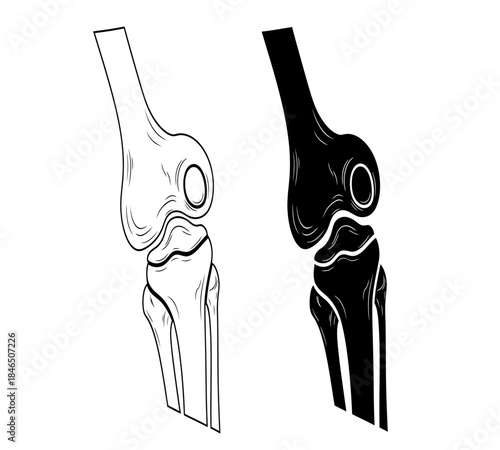 Detailed illustration showcasing the human knee joint anatomy in both light and dark contrasting views
