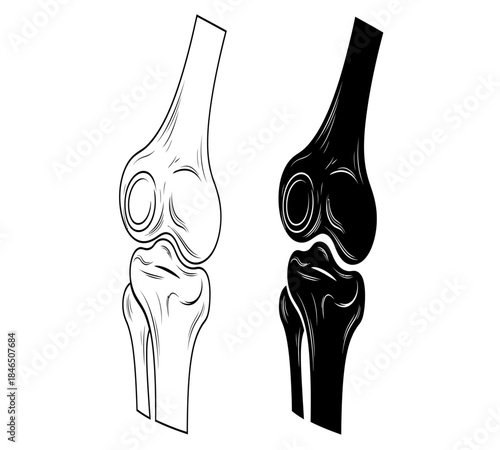 Detailed illustration of a human knee joint shown in both white and black contrasting styles highlighting anatomical structure