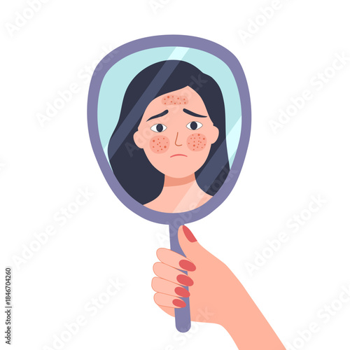 Portrait of teenager Girl looking at the mirror. Beauty, skin care lifestyle concept. Hand drawn style vector design illustrations. Young woman with acne. Skin conditions problems and dermatology.