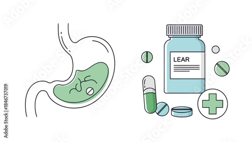 Medical Illustration of a Stomach Acid Problem and Antibiotic Medicine Representation