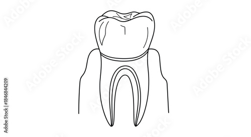 Simple black and white line drawing of a human molar tooth, showing the crown, enamel, pulp, and roots in a cross-section.