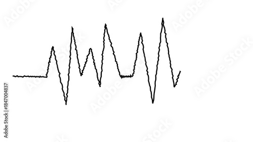 heart beat graph