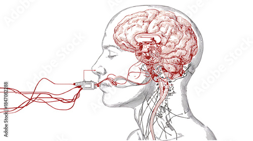  Wireless brain-computer interfaces for treating neurological disorders (2)
