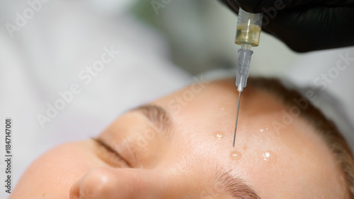 Woman receiving injection on forehead in clinic