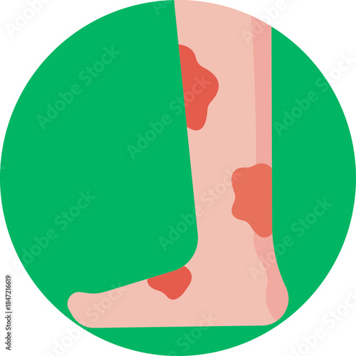 An icon representing foot complications caused by diabetes, highlighting issues such as poor circulation, nerve damage, and the risk of ulcers or infections.