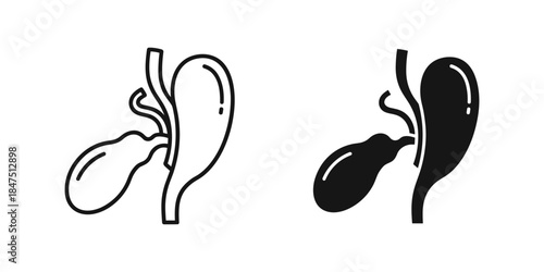 Illustration of kidneys and ureters