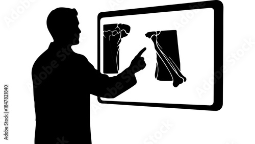 Doctor explaining x-ray with transparent background