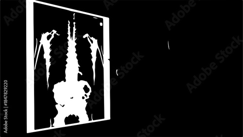 Spinal column x-ray with transparent background