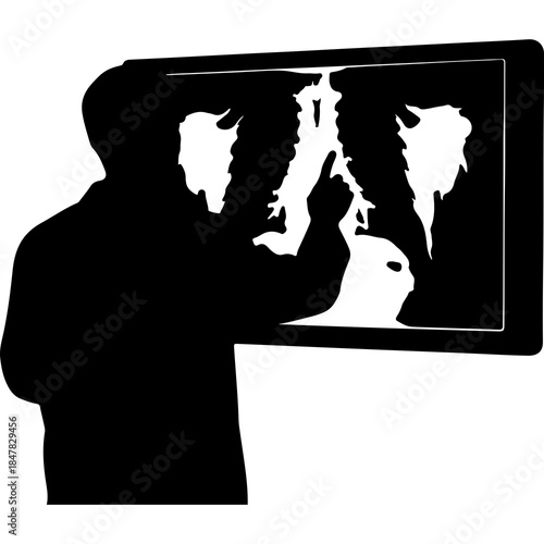Radiologist examining x-ray with transparent background