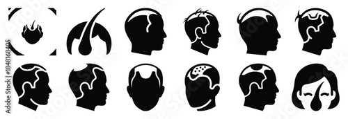 set of hair loss silhouette icon vector illustration isolated on white background