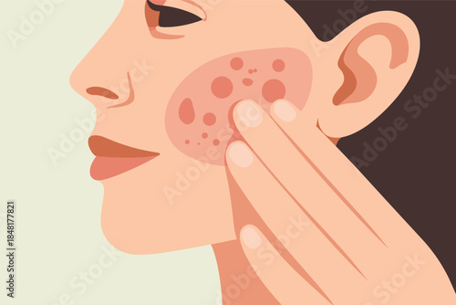 A woman examines her facial skin with acne close-up
