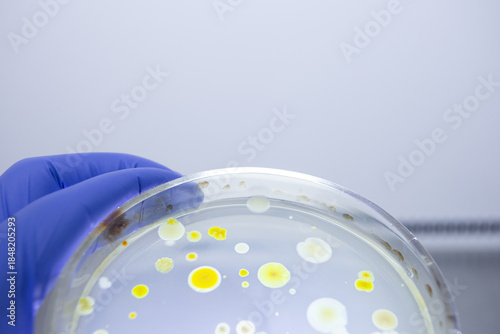 A small part of a Petri dish with colonies of bacteria illuminated by backlight, the Petri dish in the hand of a scientist.
