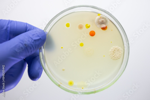 Diagnostic Petri dish with red colonies of bacteria, a method of diagnosing bacterial infection by growing bacteria on a Petri dish on agar.