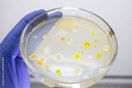 Petri dish at an angle in the hand of a scientist, many different colonies of bacteria in the petri dish, illuminated by light from behind.