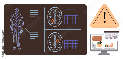 Human body outline with brain scans, warning sign, and computer displaying health data charts. Ideal for healthcare, neuroscience, diagnostics, monitoring, risk management, medical research simple
