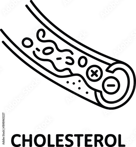 Cholesterol buildup in artery medical illustration