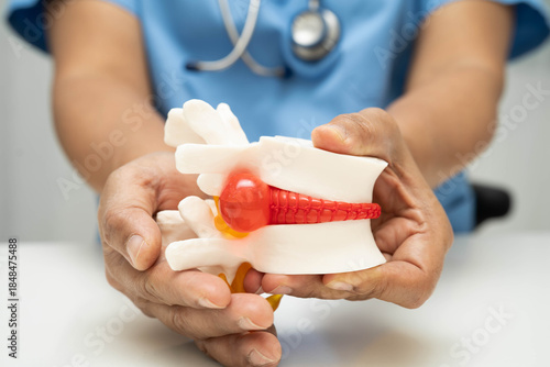 Fotografija Asian doctor holding spinal nerve and bone model.