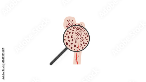 Magnified view of bone marrow cells within a bone structure.