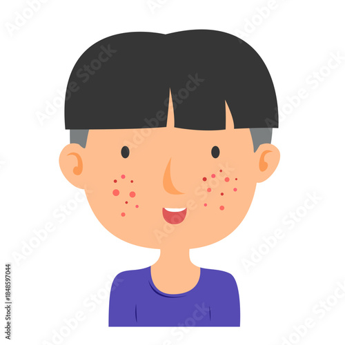 acne facial skin problem. anti acne skin care concept