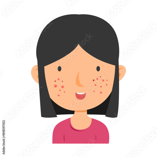 acne facial skin problem. anti acne skin care concept