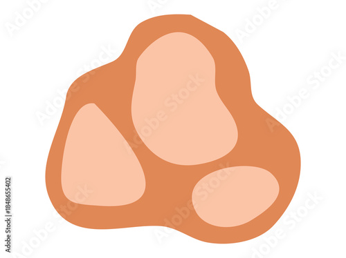 Hand Drawn Vitiligo Pigment Loss
