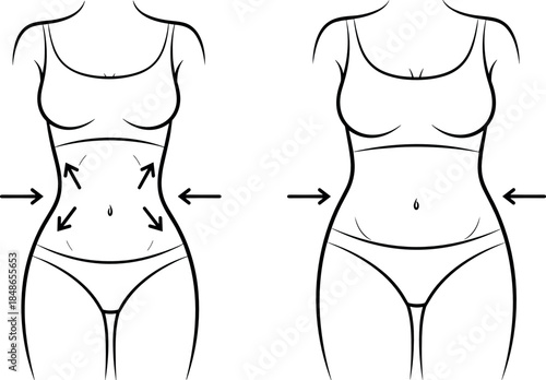 Vector outline comparison illustration of a female torso before and after body contouring, slimming, or weight loss, with arrows indicating the desired reduction area