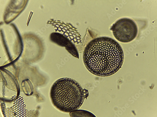 Microscopic Collection of Various Diatom Silica Shells and Biological Specimen Sli
