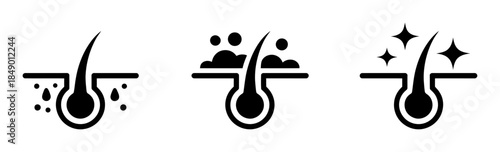 Hair follicles showing sweat oil and sparkle emissions minimal