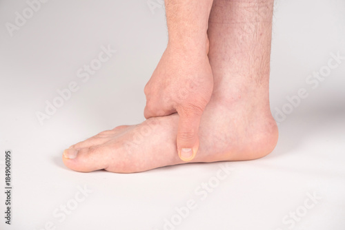 Male foot experiencing discomfort and pain from a flat feet condition or pes planus close-up, illustrating a common podiatry and health problem