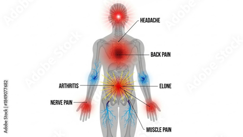 Human body with various pain points labeled for medical and health concepts