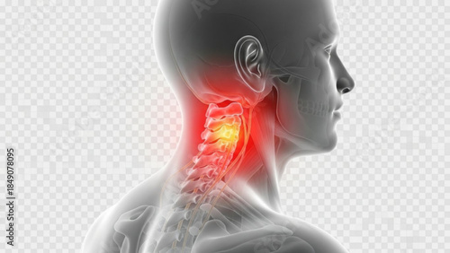 Human neck and spine with highlighted pain area in red