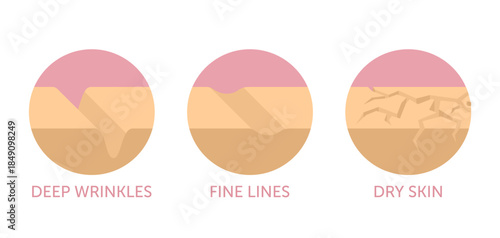 Facial skin problems icons in flat colors, for anti-age products