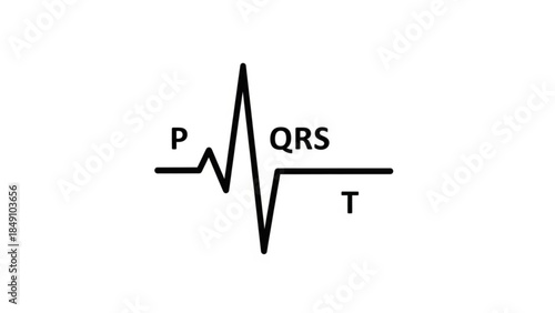 Cardiac Rhythm Diagram: An essential visual representation of a heart's electrical activity, showcasing the distinctive P, QRS, and T waveforms critical to medical understanding. 