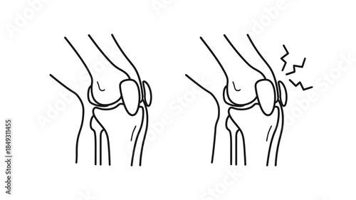 Anatomical illustration of human knee joints with flexion a black silhouette