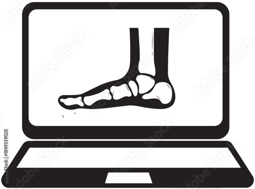 Foot X-ray On Laptop Screen Medical Technology