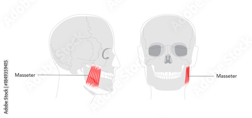 Masseter - Human chewing muscle shown in labeled diagram responsible for elevating the mandible, crucial for biting and grinding, depicted in medical illustration for dental and anatomical education.