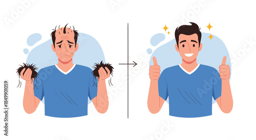 A before and after comparison showing a man's successful hair transplant, transforming from balding and sad to happy with full hair.