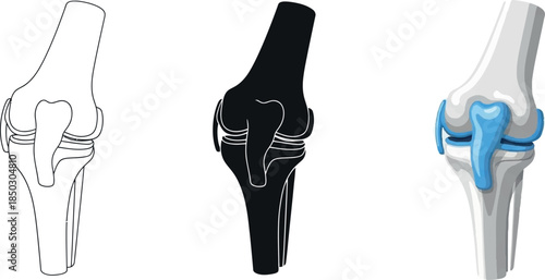 Collection of knee joint illustrations showing anatomical detail in outline silhouette and color ideal for medical and educational use