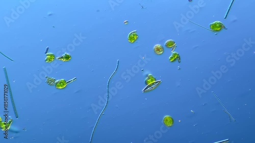 Diatoms and other microorganisms under the microscope at 100x Magnification