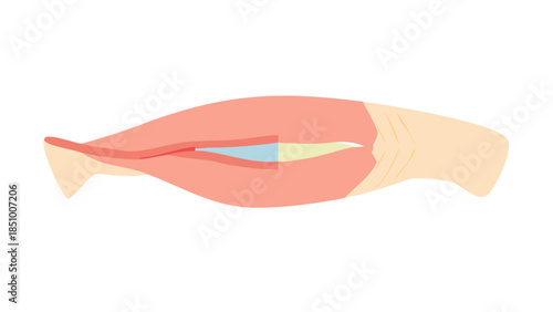 medically accurate muscle illustration of the depressor anguli oris.