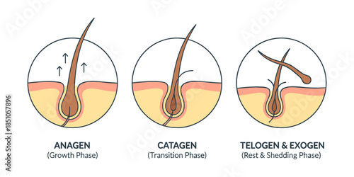 Hair growth cycle showing anagen catagen telogen exogen phases