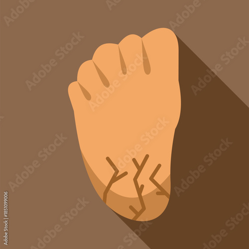 Human foot showing dry skin and cracked heel, needing medical care
