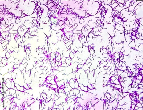 Bacillus anthracis is the etiologic agent of anthrax. A common disease of livestock and occasionally of humans. Micrograph