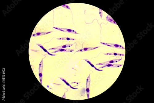 Promastigote of lishmania spp under microscope.