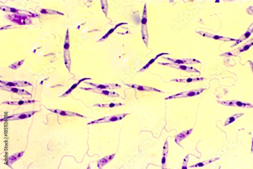 Promastigote of lishmania spp under microscope.