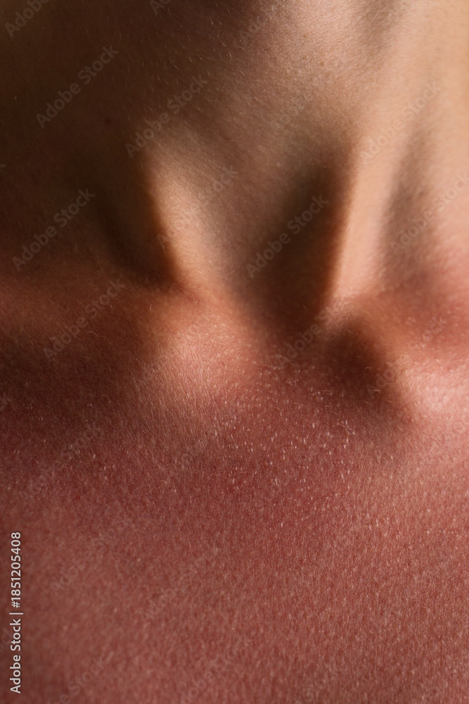 Fototapeta premium Sunburned Skin Texture on Neck and Collarbone Close-Up